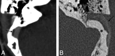 Fig 3.