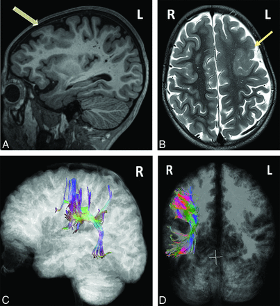 Fig 3.