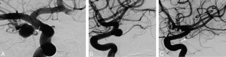 Fig 2.