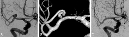 Fig 4.