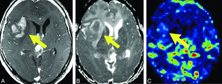 Fig 6.