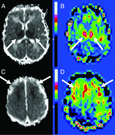Fig 4.