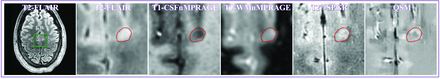 Fig 4.