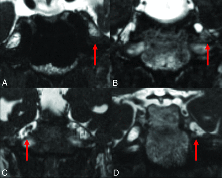 Fig 1.