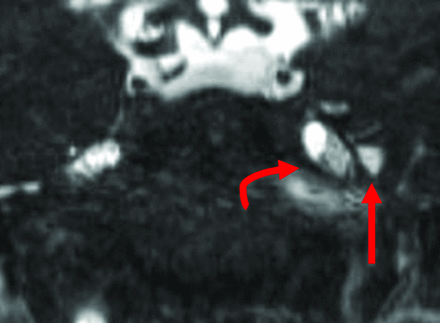 Fig 3.