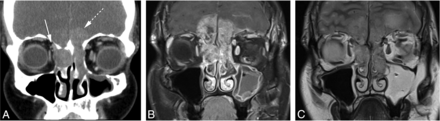 Fig 1.