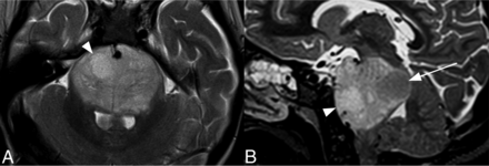 Fig 2.