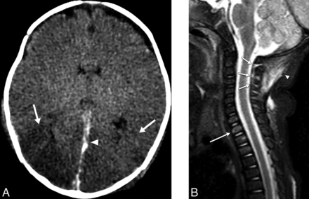 Fig 1.