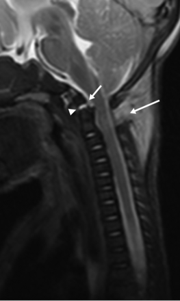 Fig 2.