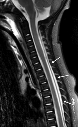 Fig 4.