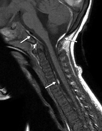 Fig 5.