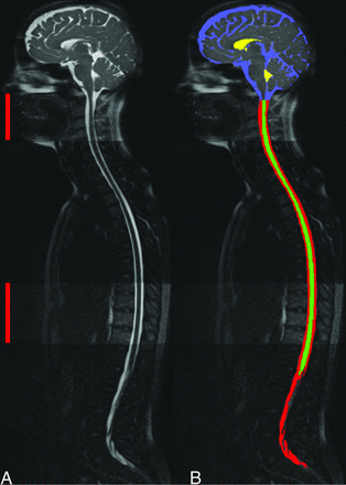 Fig 2.