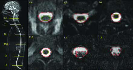 Fig 3.