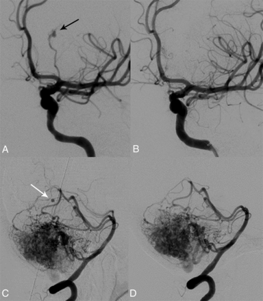 Fig 2.