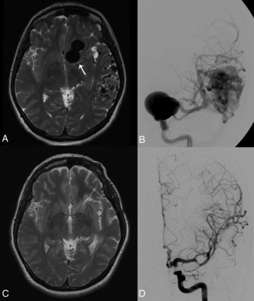 Fig 4.