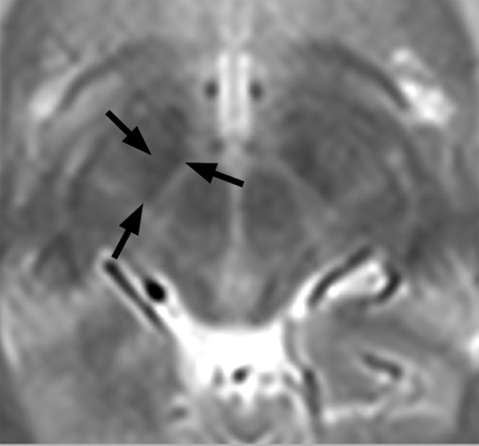 Fig 1.