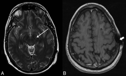 Fig 4.