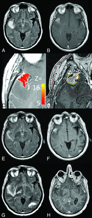 Fig 3.