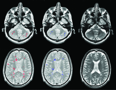 Fig 3.
