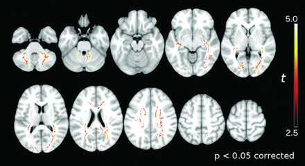 Fig 2.