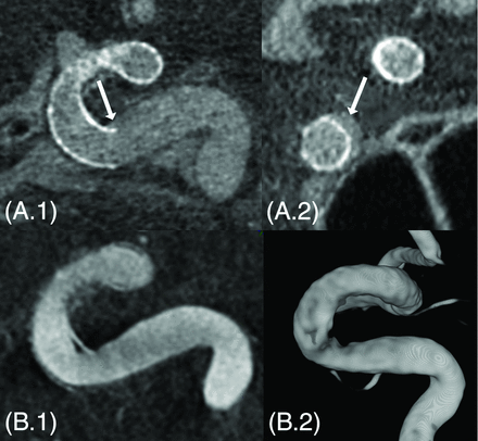 Fig 5.