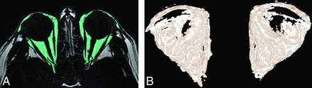 Fig 2.