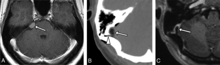 Fig 2.