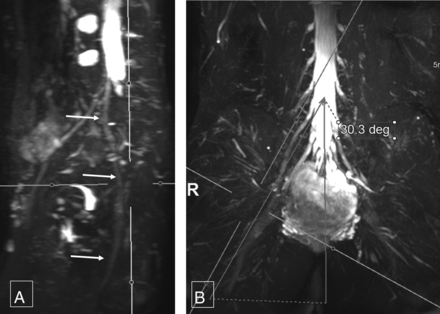 Fig 4.