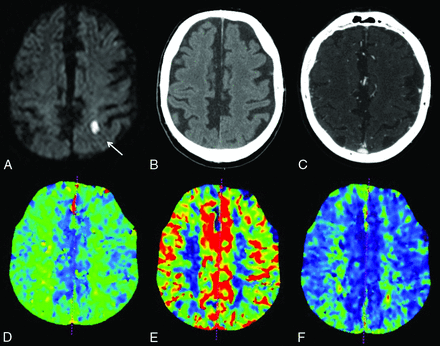 Fig 3.