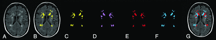 Fig 1.