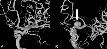 Fig 2.