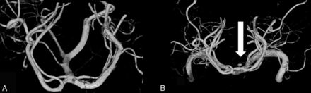 Fig 3.