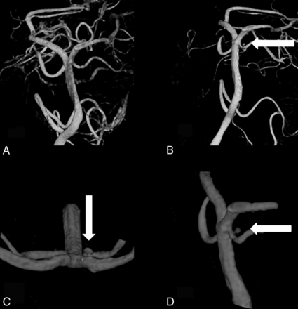 Fig 4.
