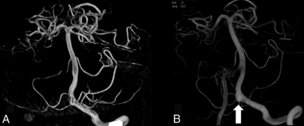 Fig 5.