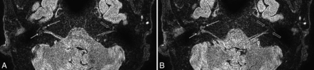Fig 2.