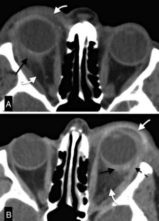 Fig 1.