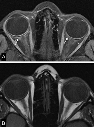Fig 2.