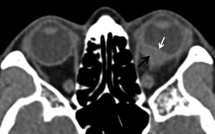 Fig 3.