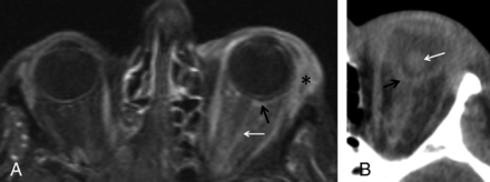 Fig 4.