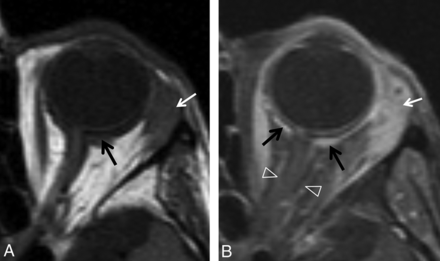 Fig 5.