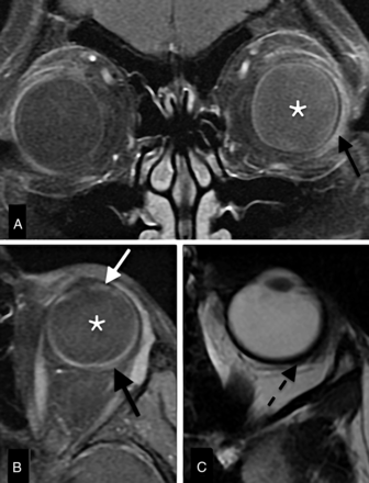Fig 6.