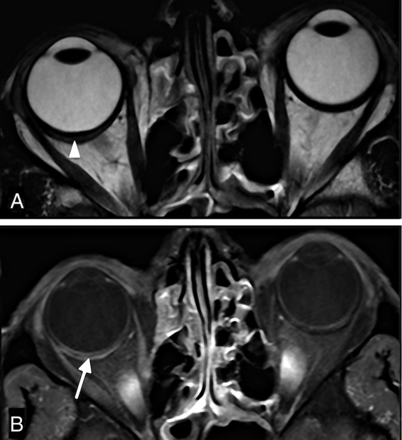 Fig 7.