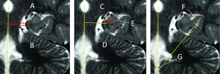 Fig 1.