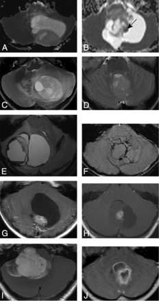 Fig 1.
