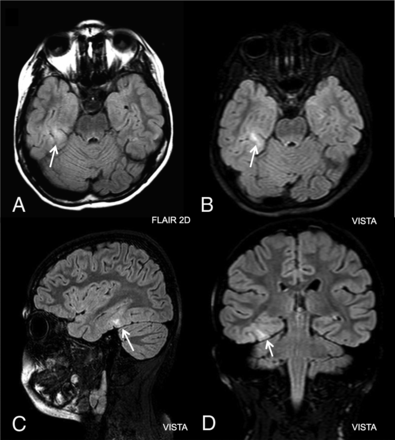 Fig 3.