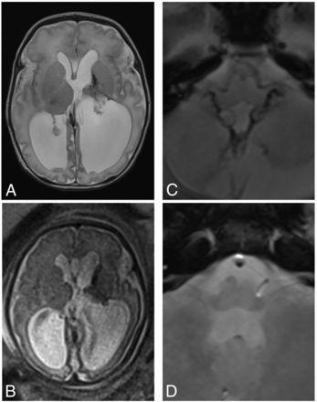 Fig 1.