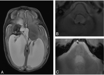 Fig 2.