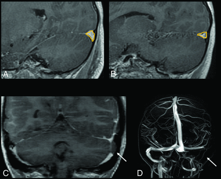 Fig 1.