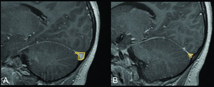 Fig 2.