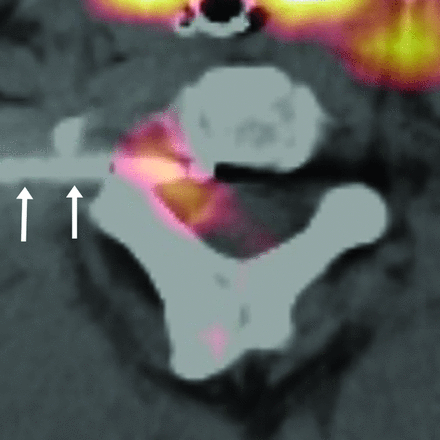 Fig 2.